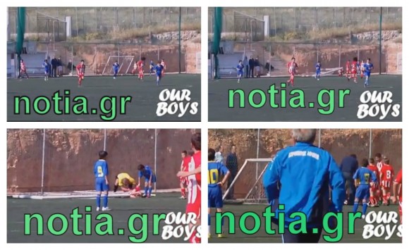 gipedokolaz1